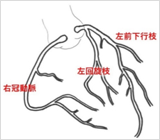 図3. 冠動脈　右冠動脈、左回旋枝、左前下行枝を表すイラスト
