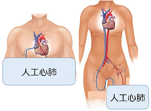 図2（Circulation: Heart Failure. 2018;11:e004905より引用改変）