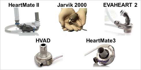 図4. 植込型左心補助人工心臓（アボット、ニプロ、センチュリーメディカル、サンメディカル、メドトロニックより提供）